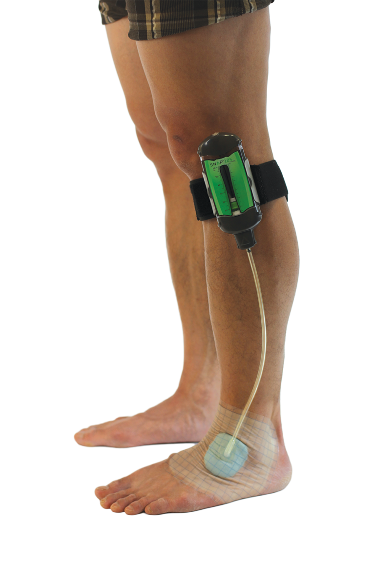 Systeme de thérapie 3M™ Snap™ · GD Medical