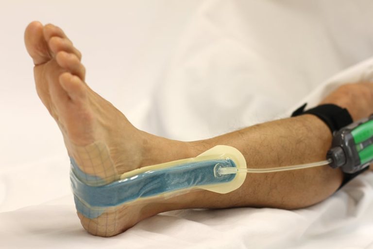 3M™ Snap™ Therapy Disposable Negative Pressure · GD Medical